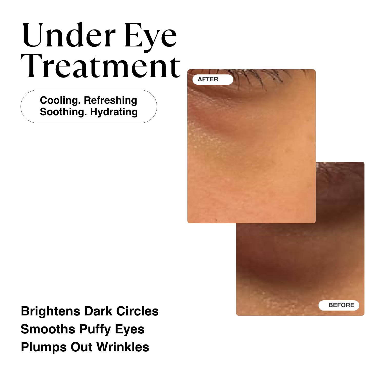 MATKAS Korean Vitamin C Eye Cream for Dark Circles and Puffiness, Bags, Wrinkles, Hydrating, Energizing, Brightening Under Eye Cream Anti Aging, Puffy Eyes Treatment - Caffeine, Peptides, Vitamin E